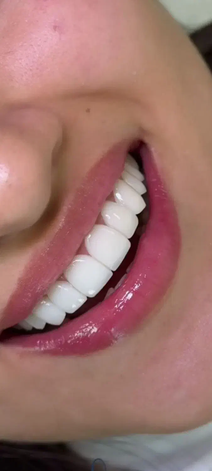 دندانسازی ،دندان مصنوعی، شیراز در شیراز، ملاصدرا، خ حکیمی غربی