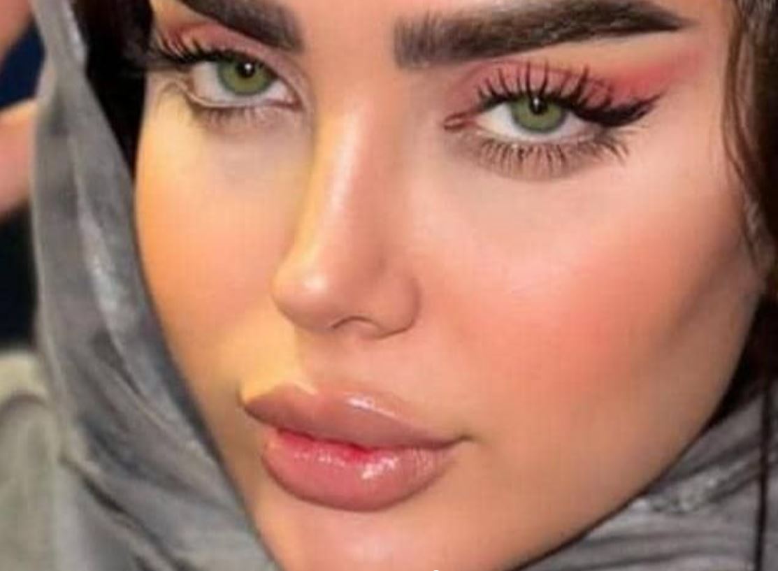 عمل بینی لیزری و فراصوت بین کبودی و درد از ۶۰ میلیون در قصرودشت شیراز