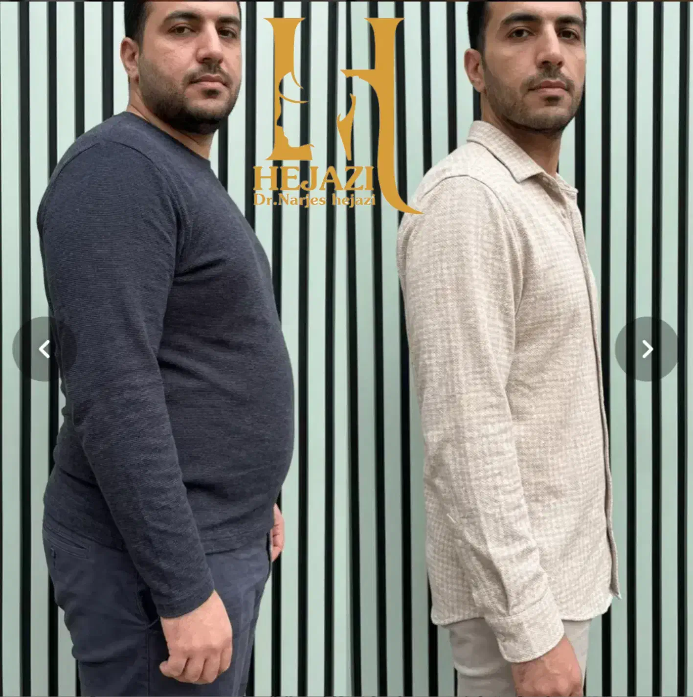 کاهش وزن با ایمپلنت لاغری در شیراز، خلدبرین، خ قصرالدشت