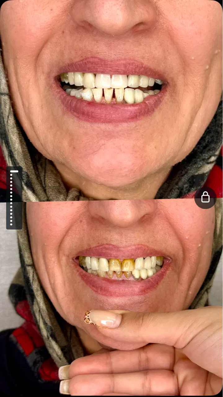 دندانپزشکی و ایمپلنت،تعرفه دولتی،بیمه،اقساط در صدرا-فارس، فاز ۱