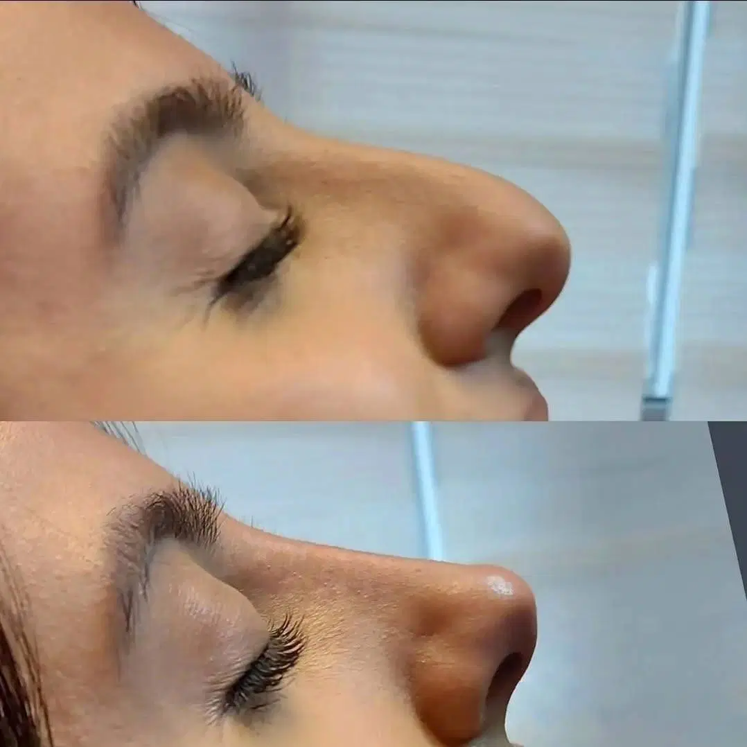 بهترین خدمات زیبایی ژل بوتاکس فیلر مزوژل لیزر در شیراز، ارم، بلوار ارم