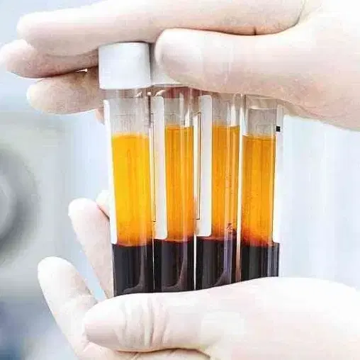 تخفیفات پی ار پیPRP مو و صورت در شیراز، بعثت، بلوار بعثت