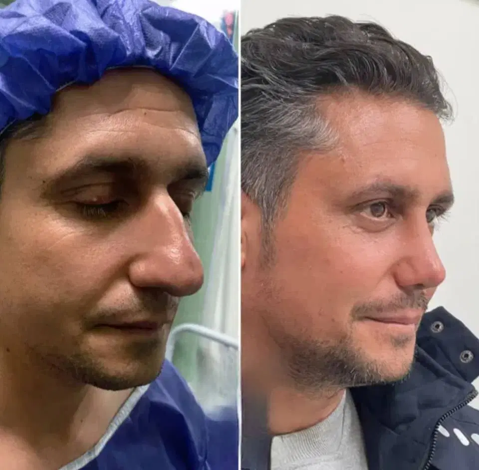 جراحی زیبایی فقط با پیش پرداخت ۲۵ میلیون در شیراز، معالی‌آباد، خ گلها
