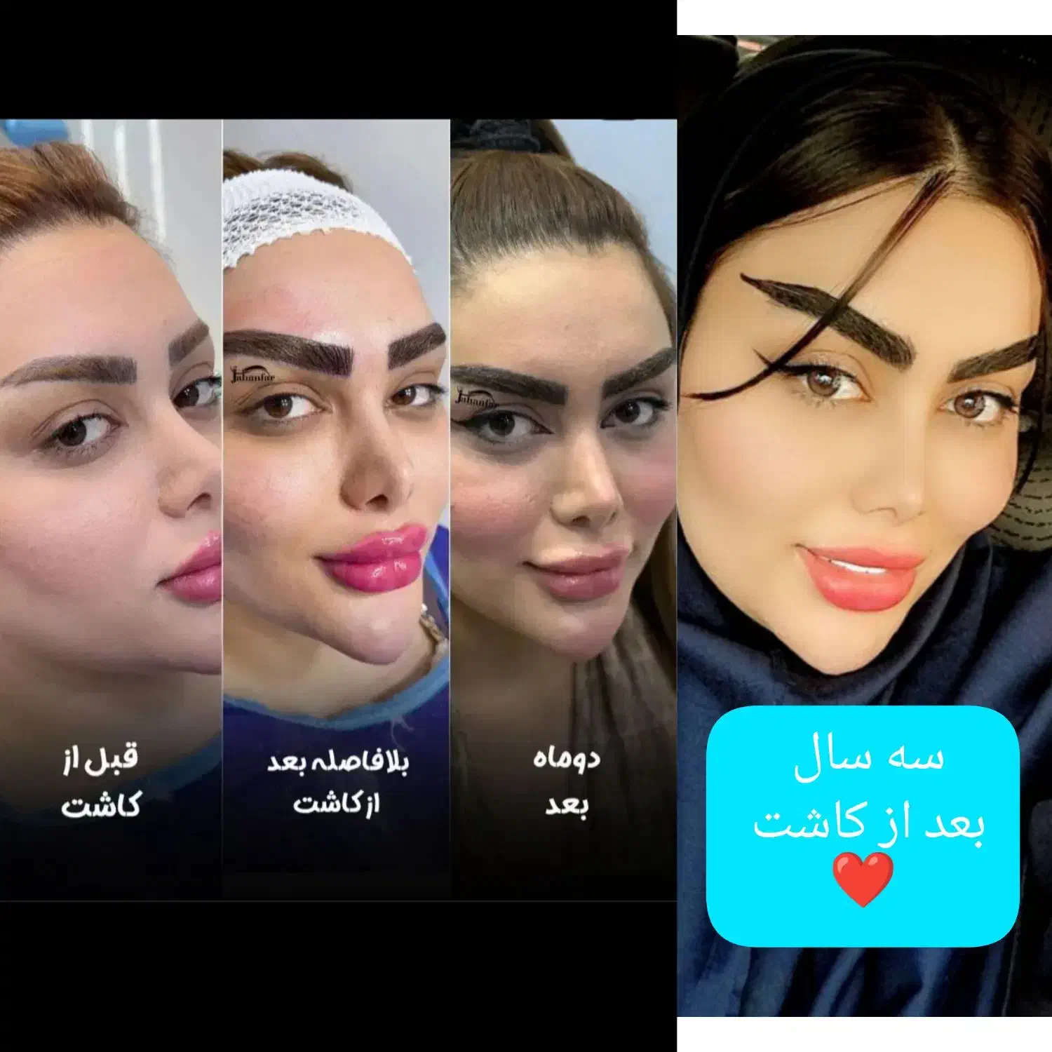 جشنواره میکرو کاشت ابرو ،کاشت مژه، آموزش تخصصی در شیراز، زرگری، خ ستارخان هجدهم