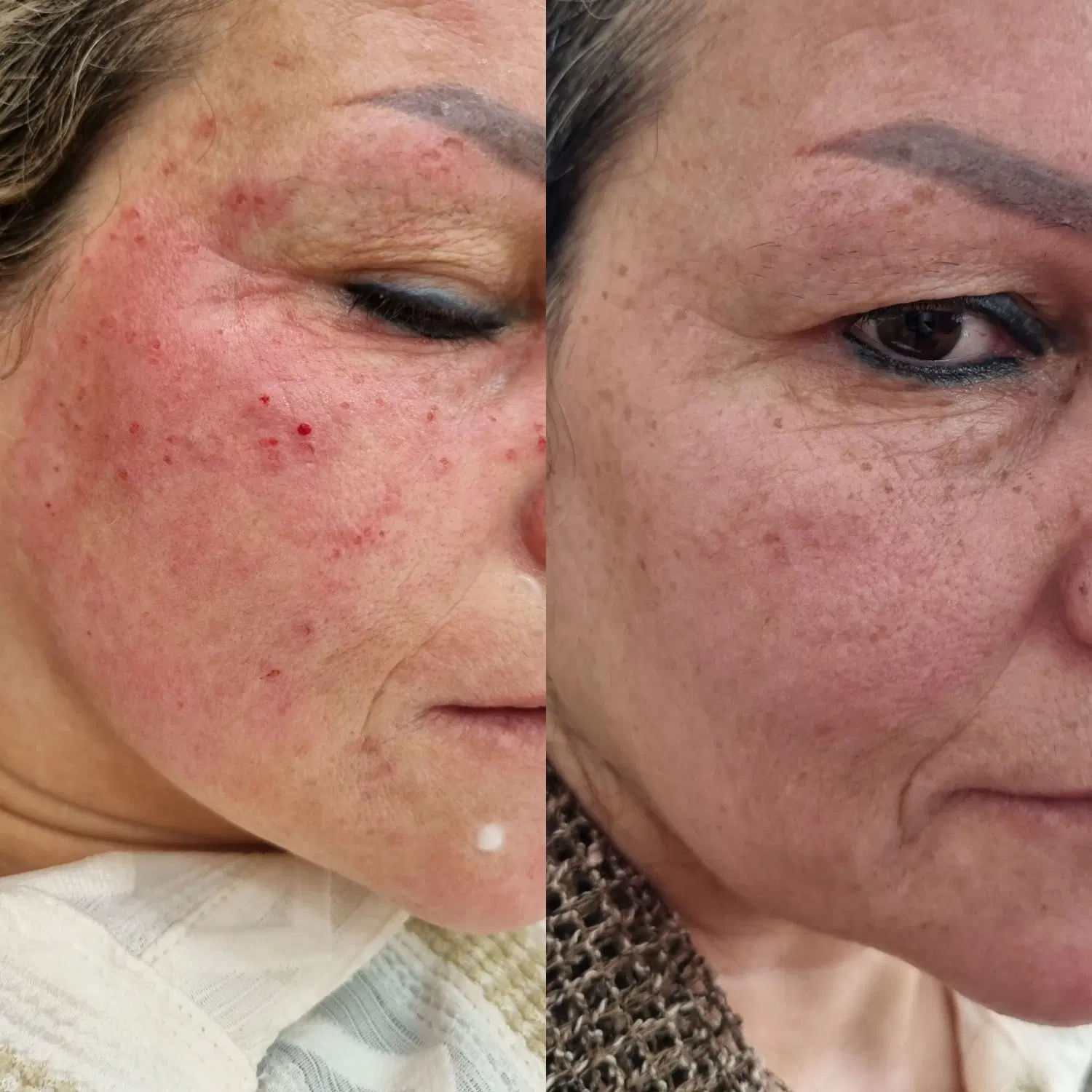 خال برداری، صافی مو کراتین وپروتین و آموزش در جهرم، خ آزادگان یازدهم