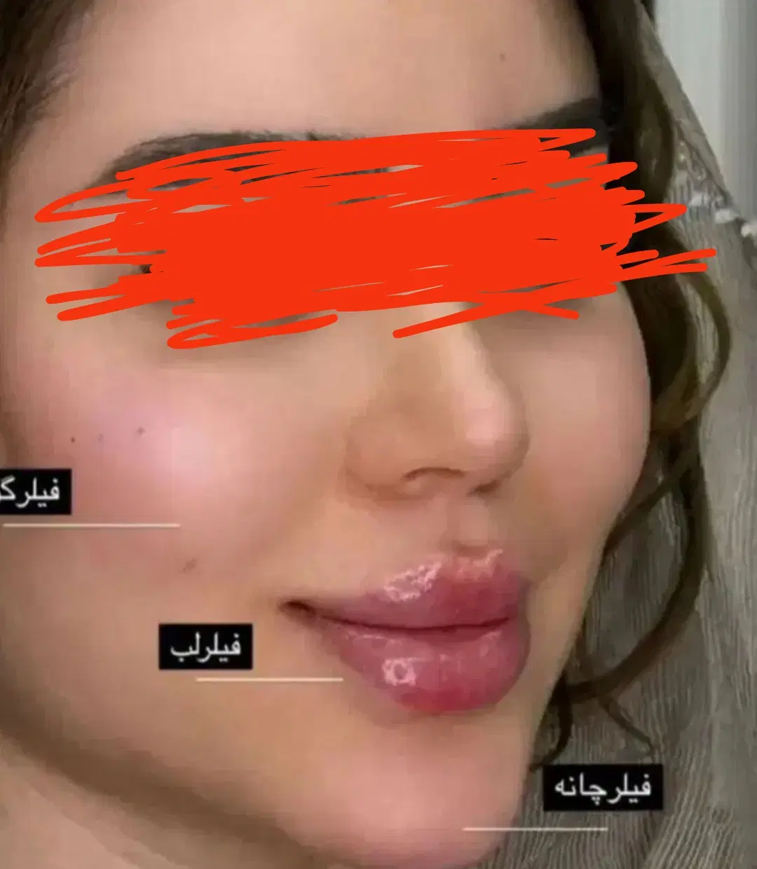 خدمات تخصصی ژل،فیلر،بوتاکس.میکروبلیدینگ ابرو در مرودشت، بیست متری بیمارستان، خ هلال احمر