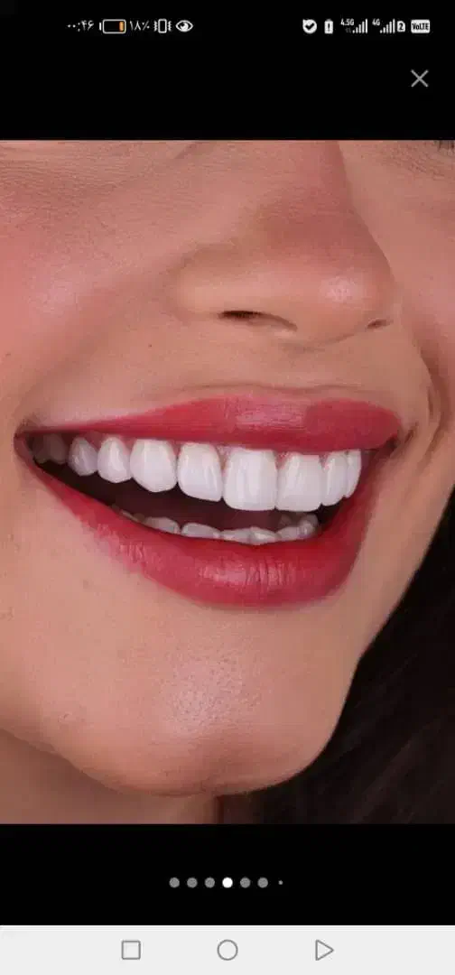 خدمات دندانپزشکی تخفیف ویژه افتتاحیه،کمترین قیمت در شیراز، عفیف‌آباد، خ عفیف آباد