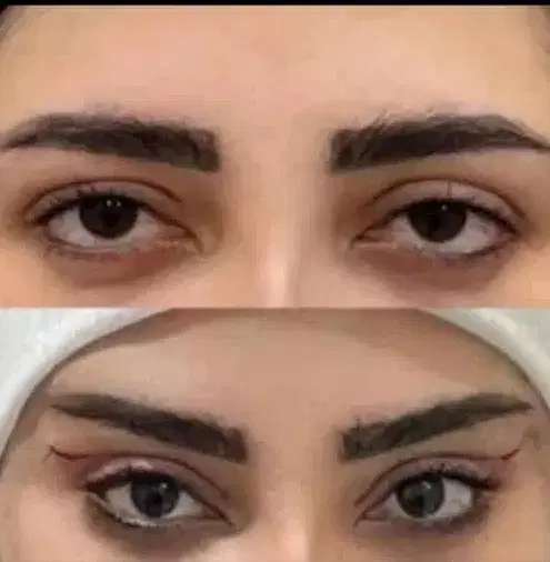 مرکز تخصصی جراحی زیبایی پلک و لیفت صورت در شیراز، معالی‌آباد، بلوار دکتر شریعتی