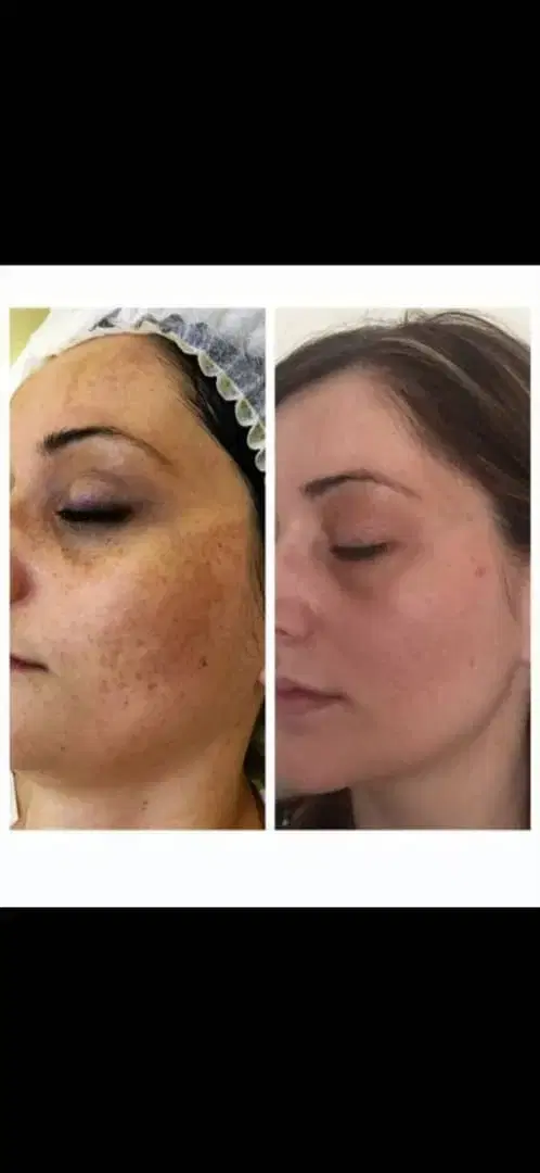 مزو تراپی و کربوکسی تراپی در شیراز، قصرالدشت، خ قصردشت ۶۲ الف