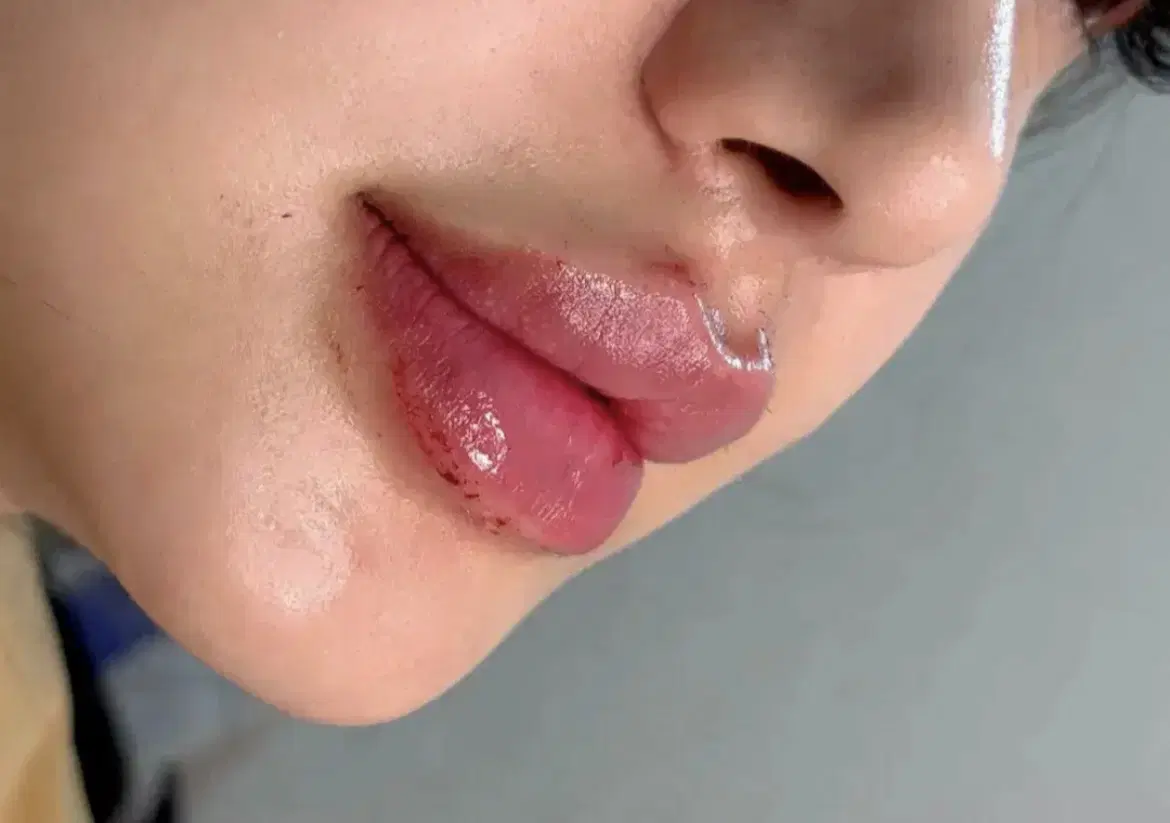 ژل و بوتاکس و آموزش در شیراز، فرهنگ شهر