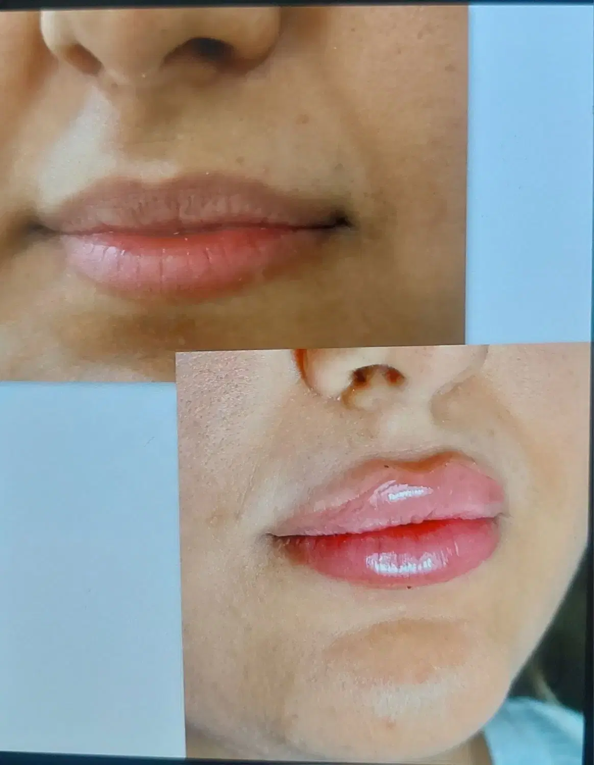 ژل و فیلر صورت در مرودشت، تامین اجتماعی، خ پاسارگارد