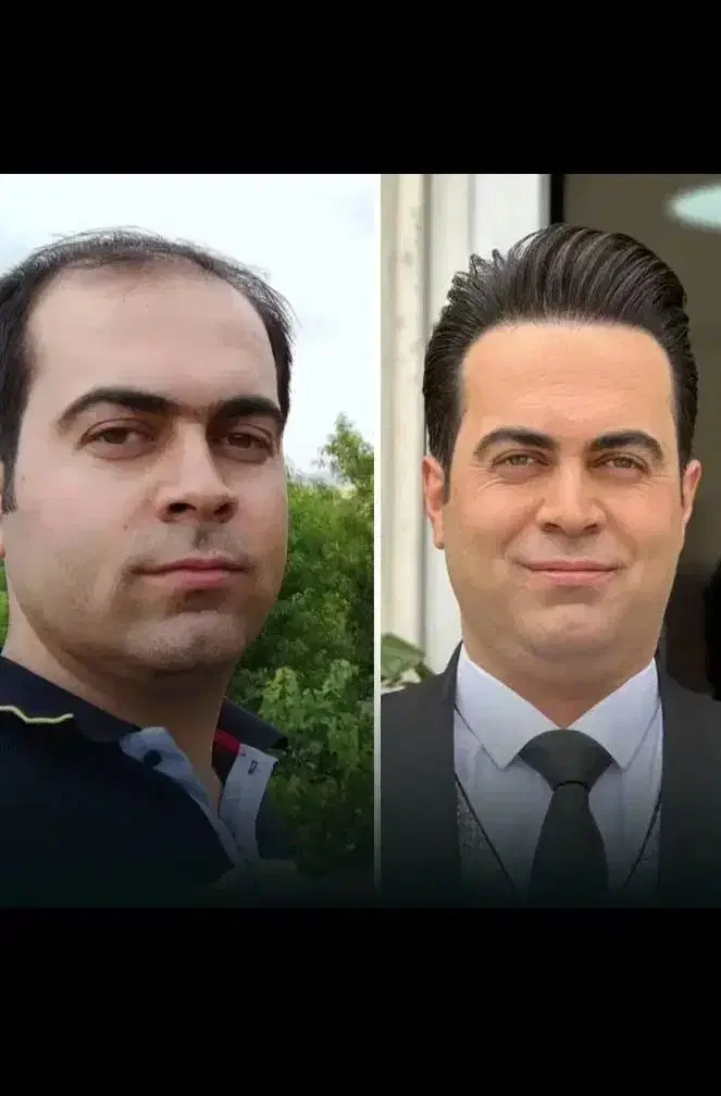 کاشت تخصصی مو در شیراز، ستارخان، خ ستارخان سیزدهم