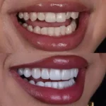 دندانپزشکی شیراز عفیف آباد دوازدهم