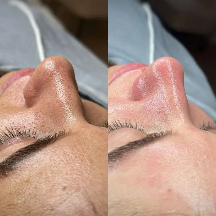 فیشیال و پاکسازی تخصصی در فسا، بلوار دکتر دوگانی