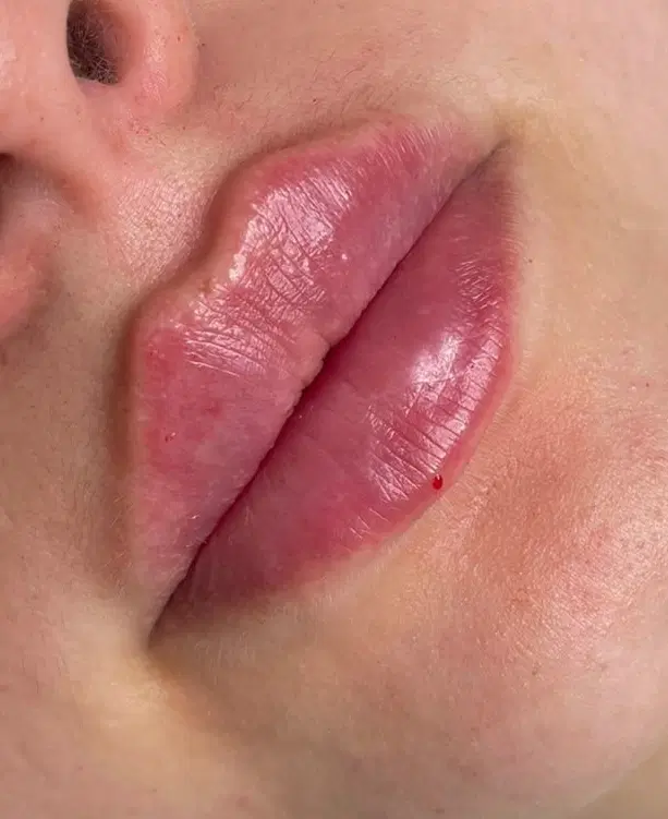 خدمات ژل و بوتاکس در فسا، خ امام حسن ۱۷