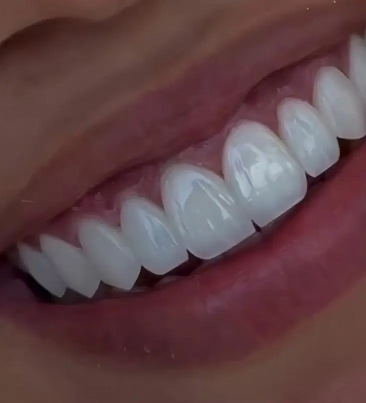 دندانپزشکی درمانی و زیبایی تعرفه قبل از افزایش در شیراز، نشاط