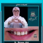 ایمپلنت دندان شیراز ملاصدرا