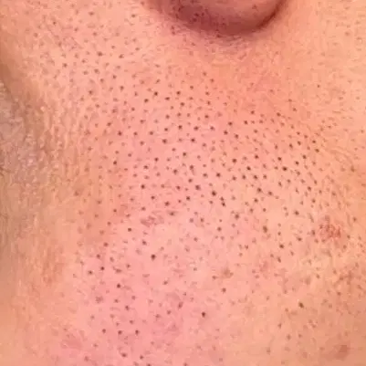 فیشیال پاکسازی مرودشت ژیان