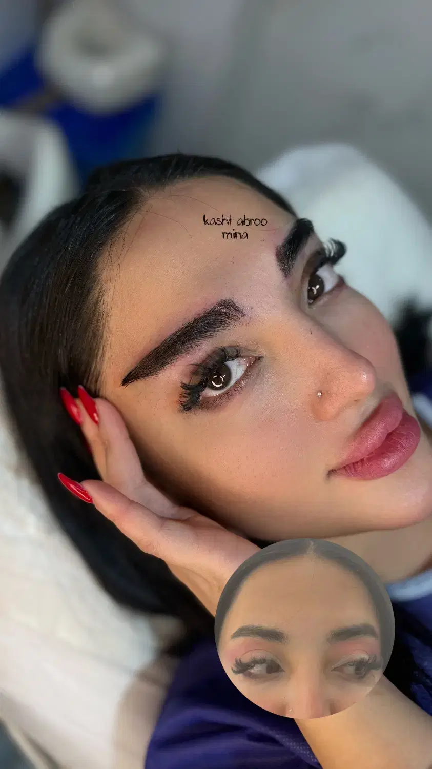 کاشت مو و ابرو کازرون خ سلمان فارسی