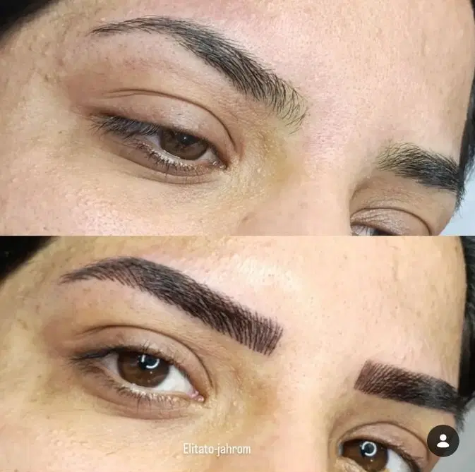 میکروبلیدینگ،فیبروز،شیدینگ،تتو در جهرم، خ حر ۱۰